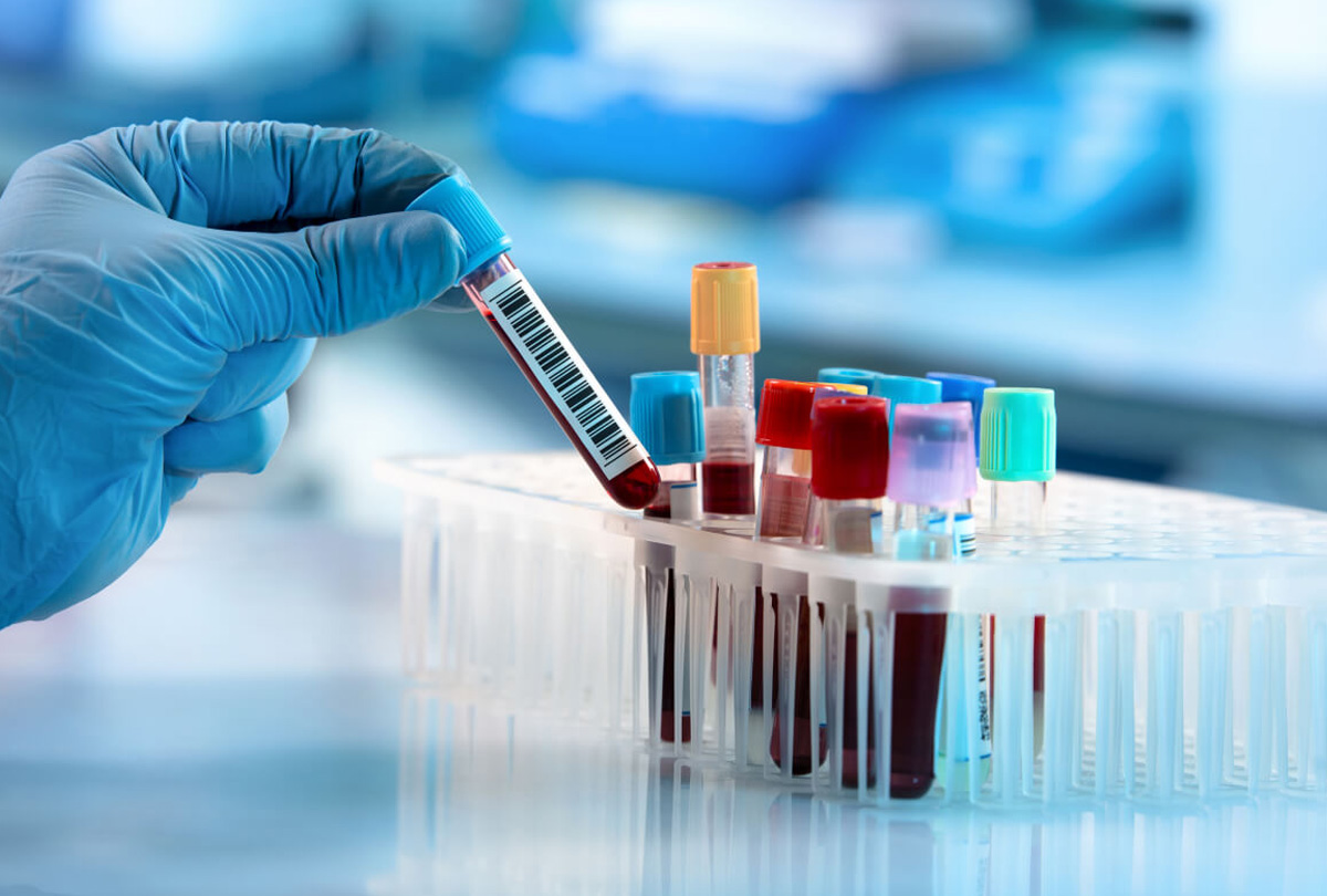 DMLT - Diploma in Medical Laboratory Technology